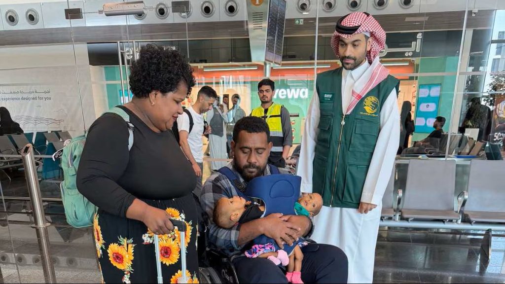 Complex surgery successfully separates Fijian conjoined twins